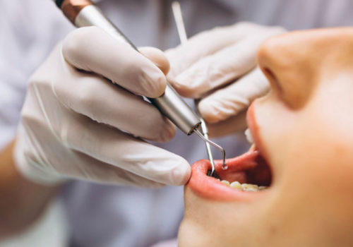 Ipersensibilità Dentale: Cause E Rimedi